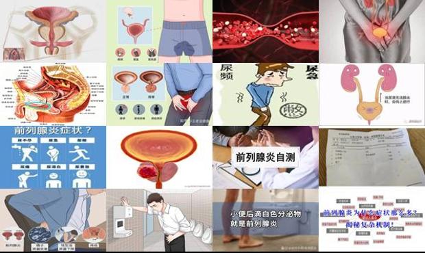 尿道旁腺炎要治多久 - 汕头尿道旁腺炎症状