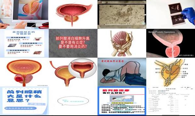 前列腺液多少钱 - 汕头前列腺液怎么提取