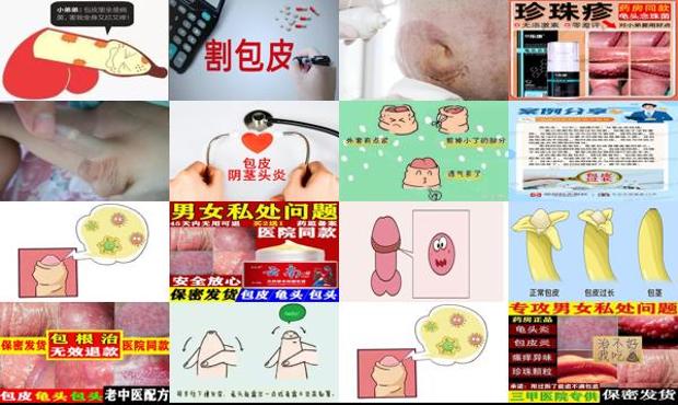 包皮里面有炎症怎么办 - 汕头包皮内有炎症