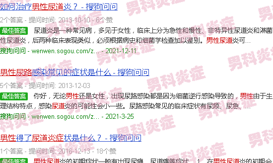 汕头男性尿道炎症