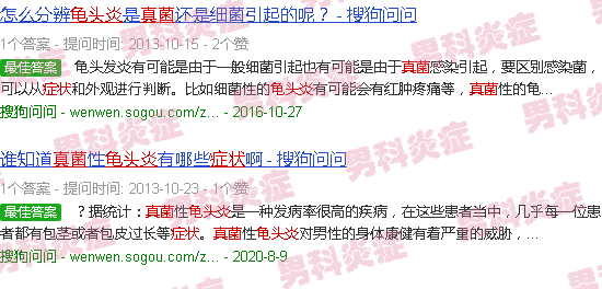 汕头真菌龟头炎症状图片