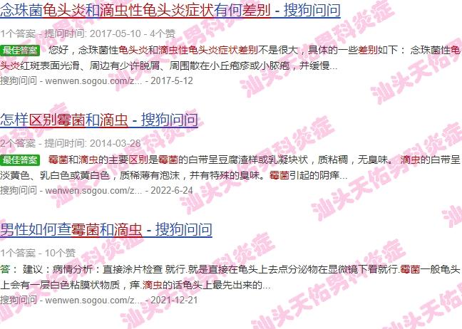 滴虫鬼头炎症状 - 汕头滴虫龟头炎症状和霉菌区别