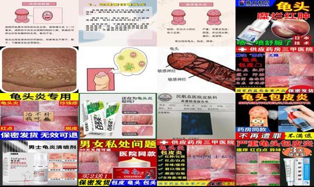 真菌性龟炎症状图片 - 汕头真菌性龟头炎症状图片