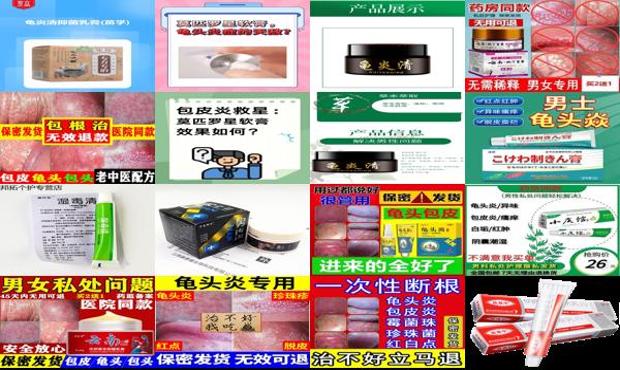 治疗鬼头炎的药 - 汕头鬼头炎症用什么软膏