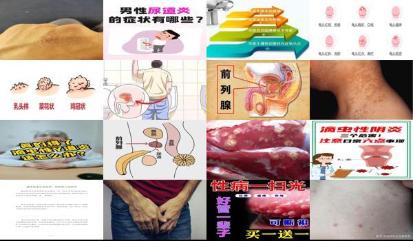 男生患滴虫性 - 汕头男性得滴虫性炎症有什么症状