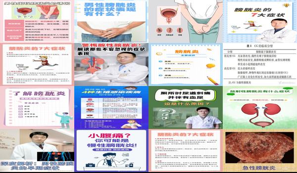 汕头男性膀胱炎症状有哪些 - 汕头男性膀胱炎症状