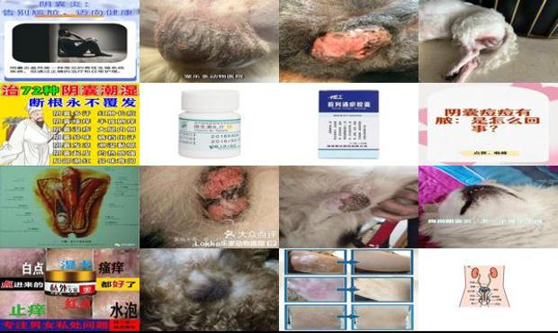 阴囊炎可以治愈吗 - 汕头阴囊炎症能自愈吗