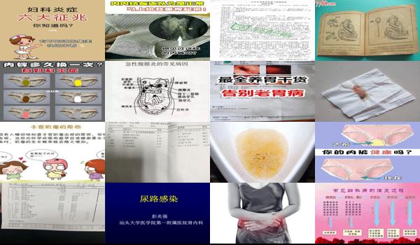 下腹部胀胀的老是感觉有尿意但又设尿多少,&hellip; - 汕头下腹总感觉胀尿是怎么回事,没有炎症