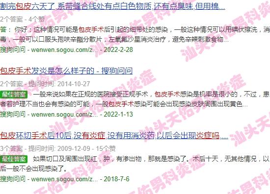 汕头做完包皮手术有炎症吗多少钱 - 汕头做完包皮手术有炎症吗