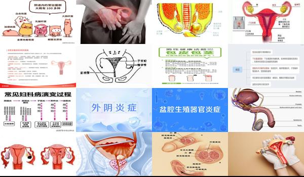 生殖道炎症用什么药 - 汕头生殖器管炎症什么药