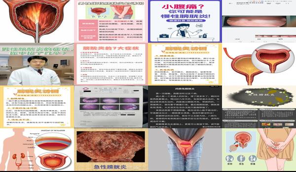 汕头男性膀胱炎症状及治疗医院 - 汕头男性膀胱炎症状及治疗
