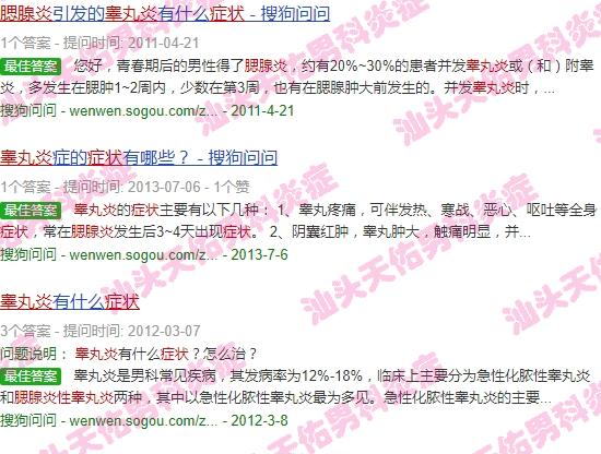 腮腺炎性睾丸炎的症状 - 汕头腮腺炎性睾丸炎症状