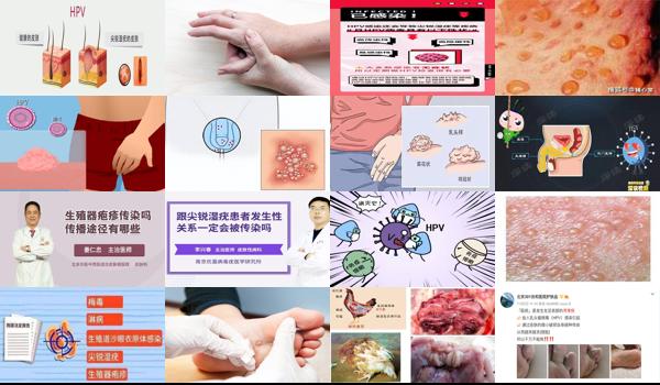 汕头生殖科哪个医院好 - 汕头生殖器炎症是怎么传染的