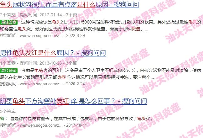 汕头沟头村 - 汕头龟头沟股发红炎症是什么病