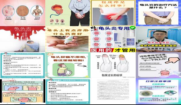 汕头男科性疾病 - 汕头龟头炎症的话正常情况下，自然好得多久