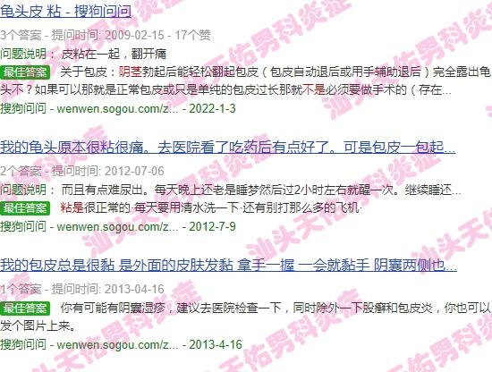 汕头市割包皮 - 汕头阴茎皮发粘是不是炎症