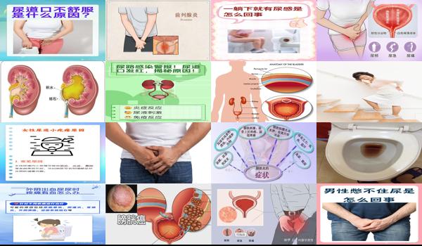 汕头泌尿医院正规吗 - 汕头尿路炎症的症状