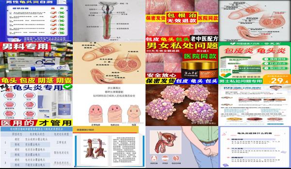 阴径发炎怎么治疗 - 汕头阴径外面有炎症怎么回事
