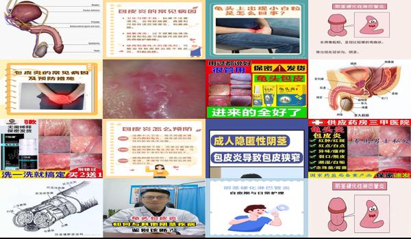 阴劲炎症是什么症状 - 汕头阴经炎症状