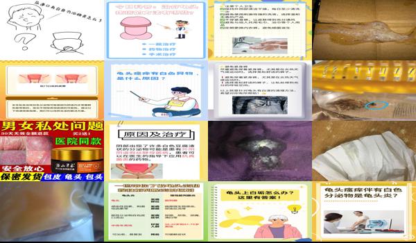 汕头男科性疾病 - 汕头龟头炎症每天都有一些白色物怎么办