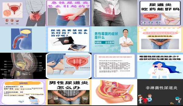 霉菌性尿道炎男的怎么治疗 - 汕头男方霉菌性尿道炎症状