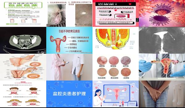 汕头生殖医院 - 汕头生殖器上的炎症严不严重